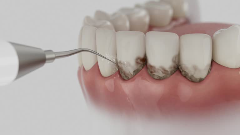 Reliable Emergency Dentist contractor in Lima, OH by Smile Center Dentistry